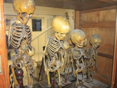 Lizbon Üniversitesi Anatomi Bölümü 'nden organ koleksiyonu. 18 Kasım 2021, Lizbon, Portekiz: Lizbon Üniversitesi Tıp Fakültesi Anatomi Bölümü 'nün organlarının toplanması