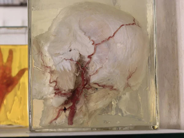 リスボン大学医学部解剖学教室の臓器のコレクション 2021年11月18日ポルトガル リスボン リスボン大学医学部解剖学教室の臓器収集の様子 — ストック写真