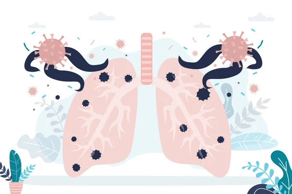 Poumons Atteints Pneumonie Coronavirus Attaque Cause Des Maladies Pandémie Covid — Image vectorielle