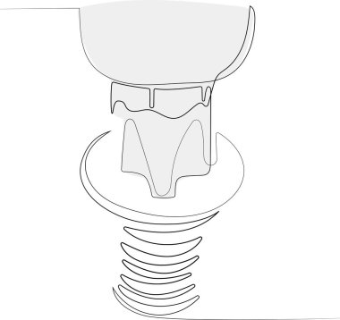 Tornavida vidası cıvata anahtarı vida ve fındık