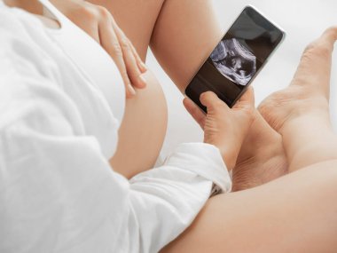 Beyaz elbiseli, çıplak, koca göbekli hamile bir kadın beyaz bir odada oturuyor ve doğmamış çocuğunun ultrason taramasına bakıyor. Müstakbel anne, bebeğinin ilk fotoğrafına hayran. Yukarıdan görüntüle.