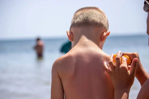 Mamma Mette Panna Sulla Schiena Del Figlio Prendersi Cura Della — Foto Stock