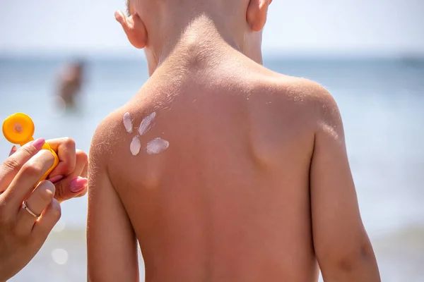 Mother Puts Cream Her Son Back Caring Baby Skin Sunscreens — Stock Photo, Image