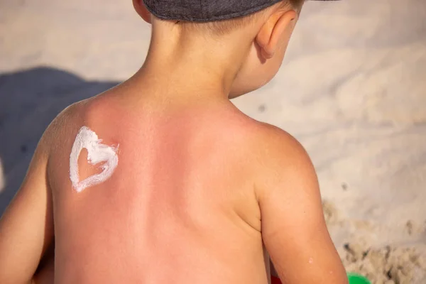 Mom Puts Sunscreen Sin Back Shape Heart Selective Focus — Stock Photo, Image
