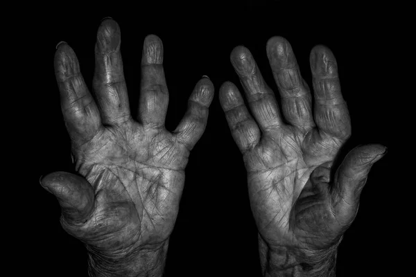Old Dirty Black White Hand Dark Background — Stockfoto