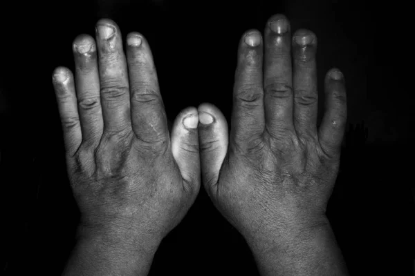 Hand Woman Hands Black Background — Stockfoto