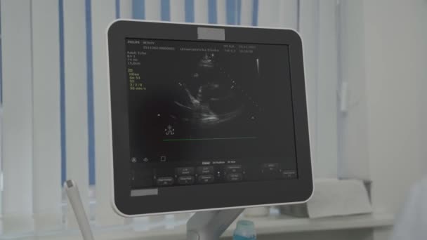 女性医師は心臓病クリニックで現代的な機器を使用して患者の男性の心臓チェックを行います.女性の心臓科医は超音波検査で患者の心臓をスクリーニングしています,画面を見て.医療の概念 — ストック動画