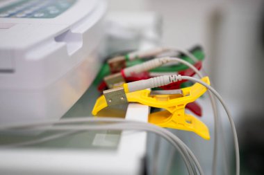 EKG konsepti. Kadın kardiyolog, kardiyoloji kliniğindeki hastaya elektrokardiyogram testi yapıyor. Tıp, kardiyoloji, kalp konseptinin EKG 'si. Tıbbi testlerde erkek..