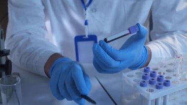 Laboratuvar teknisyeni testler ve analizler yapar. Kan örnekleriyle işaretlenmiş ince tüpler. Mavi lastik eldiven giyiyor. Mikrobiyolojik ve kimyasal testler. Araştırmacı laboratuardaki kan örneklerini etiketliyor.