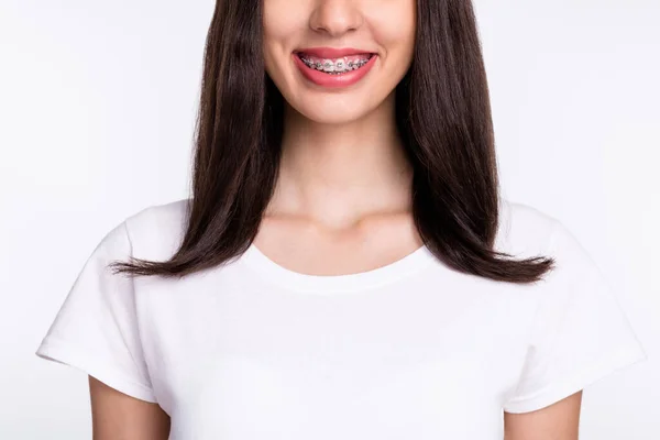 Retrato de vista recortada de una atractiva chica alegre con tirantes en dientes blancos aislados sobre fondo de color gris claro — Foto de Stock