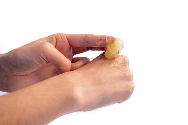 Woman Applying Petroleum Jelly Her Hand Isolated White Background Young — Stock Photo, Image