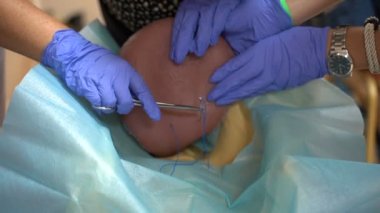 Training for surgeon students on mannequins. An artificial stomach is sutured with medical instruments