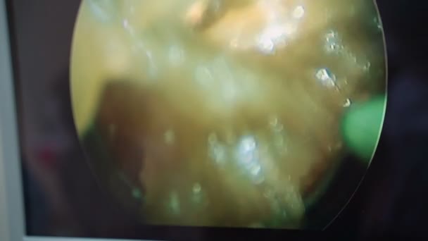 Training Surgeon Students Mannequins Insides Pumpkin Examined Edoscope — Stock Video