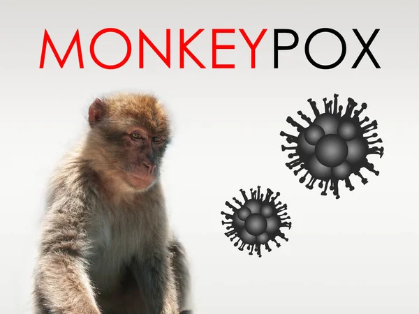 サルの水痘、感染症のイラストは、サルの水痘ウイルスによって引き起こされる。多国間の発生、新しいケース。ウイルス性ゾーン性疾患、危険な感染症. — ストック写真