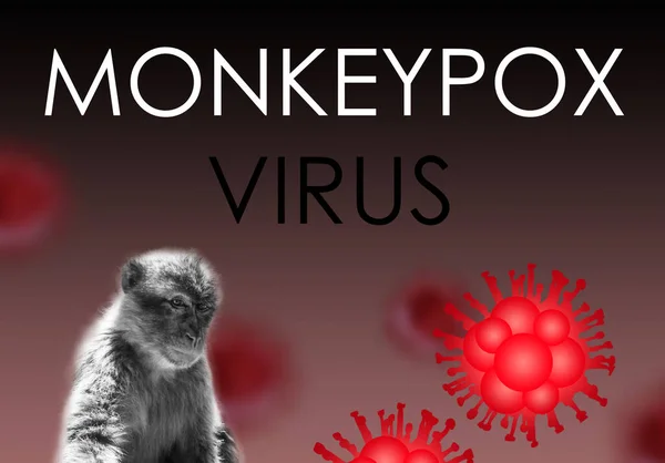 サルの水痘、感染症のイラストは、サルの水痘ウイルスによって引き起こされる。多国間の発生、新しいケース。ウイルス性ゾーン性疾患、危険な感染症. — ストック写真