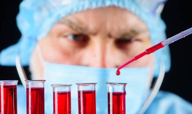 Doktor klinikteki kan örneğini analiz ediyor. Test tüpleri ve pipeti olan bir bilim adamı. Kan testi yapan bir laboratuvar teknisyeni. Yakın çekim..