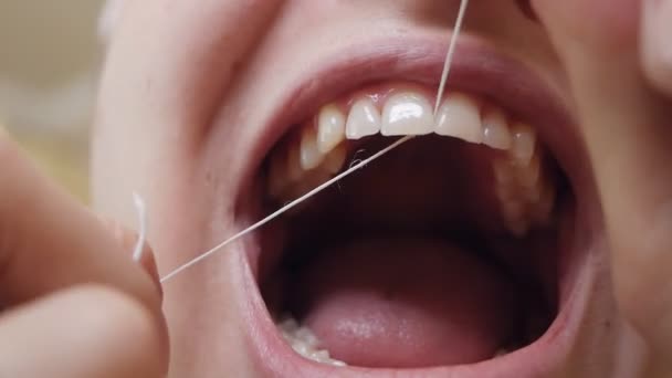 Крупным планом женщина чистит зубы зубной нитью, удаляя остатки еды из межзубного пространства — стоковое видео