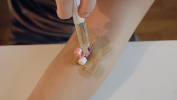 Close-up on the hand of a syringe with a catheter, injection of medication, dropper — Stockvideo