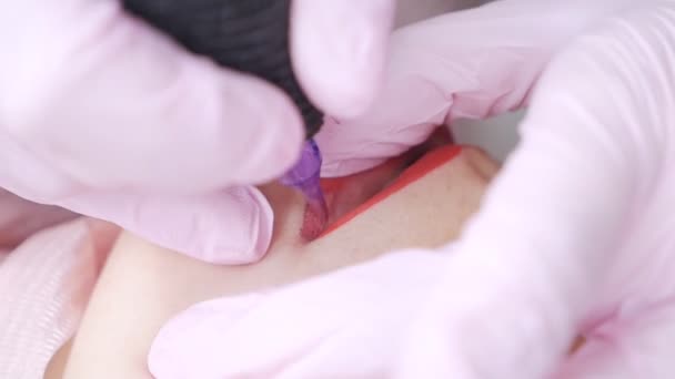 Татуировка губ на микролезвии специальным красным пигментом, который корректирует цвет губ в косметологической клинике — стоковое видео