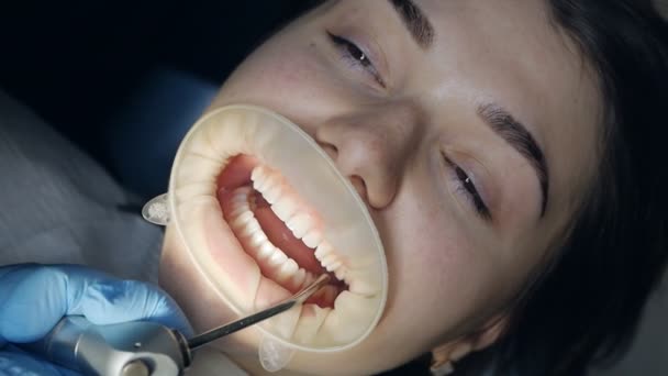 Dentista faz um procedimento para clareamento dos dentes. Belo sorriso. Lâmpada ultravioleta para clareamento dos dentes — Vídeo de Stock