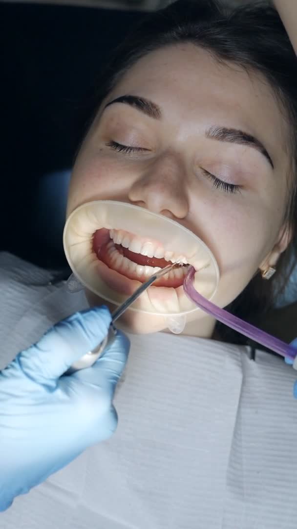 Jonge vrouw met een retractor in haar mond in een tandheelkundige kliniek. Tanden poetsen met water. Tandarts met speeksel ejector of tandheelkundige pomp — Stockvideo