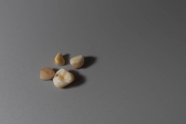 Bebeğin bakıcılıktan etkilenen süt dişleri çocuktan düştü..