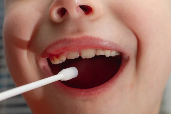 Anak Itu Menyemprotkan Obat Mulutnya Anak Itu Memperlakukan Tenggorokan Sakit — Stok Foto