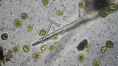 Planktonlu yeşil infusorialar ve basiller mikroskop altında büyütülmüş nehir suyunun damlasında hareket ederler
