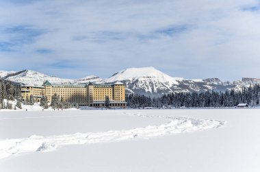 Donmuş ve karla kaplı Louise Gölü, otel ve Kanada Banff Ulusal Parkı Alberta 'daki Rocky Dağları