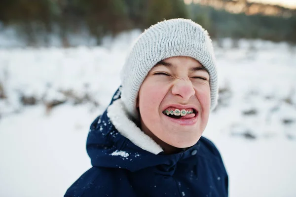 Αγόρι Σιδεράκια Δείχνουν Αστείο Πρόσωπο Στη Χειμερινή Φύση Εξωτερικές Πόρτες — Φωτογραφία Αρχείου
