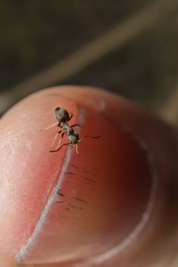 Parmağında siyah bahçe karıncaları