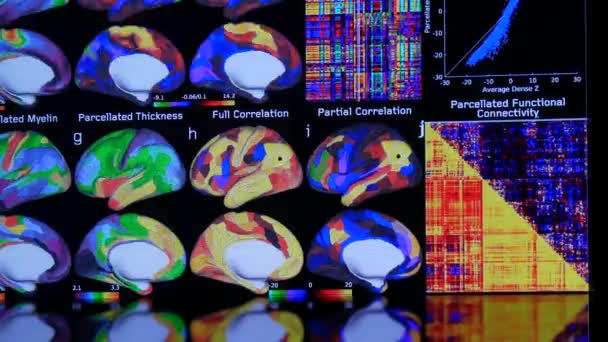 Karlsruhe Germany August 2022 Digital Screen Computed Tomography Brain Scans — Vídeo de stock
