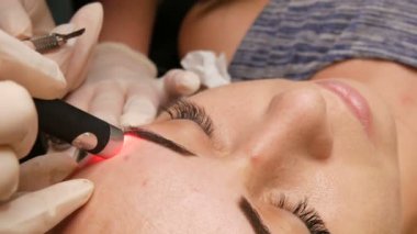 Güzel kız modeller özel bir kozmetoloji lazeri kullanılarak kaşlarında pigmentasyon olup olmadığına bakılır. Kaş şekli düzeltmesi. Mikro patinaj, kalıcı makyaj, dövme. Yüzünü kapat.