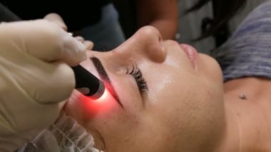 Güzel kız modeller özel bir kozmetoloji lazeri kullanılarak kaşlarında pigmentasyon olup olmadığına bakılır. Kaş şekli düzeltmesi. Mikro patinaj, kalıcı makyaj, dövme. Yüzünü kapat.