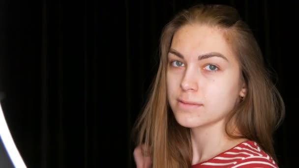 Gyönyörű Hosszú Hajú Lány Problémás Bőrrel Pózol Kamera Előtt — Stock videók