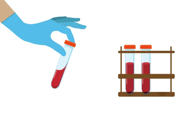 Флаконы с компонентами крови пробирка с кровью, медицинская пробирка в руках медицинского работника. — стоковый вектор