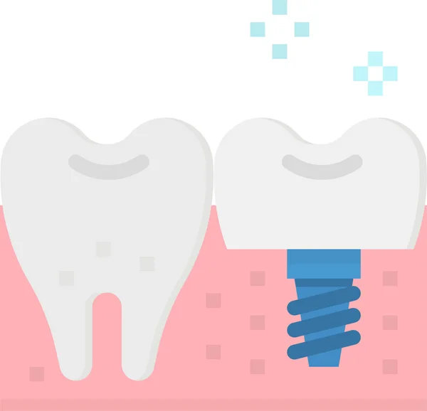 Zahnarzt Implantat Ikone Flachen Stil — Stockvektor