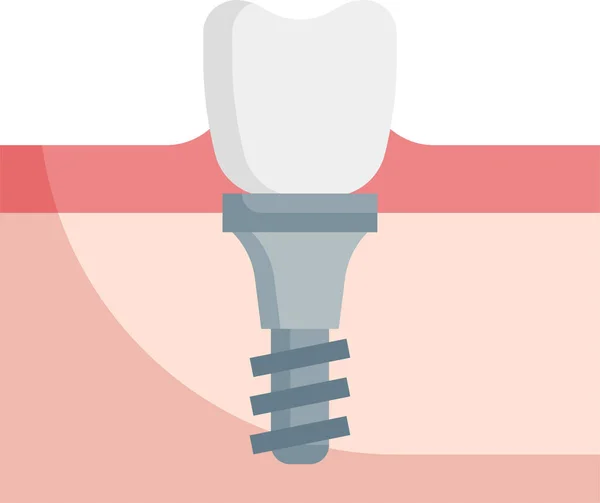 Zahnimplantat Zahnarzt Symbol — Stockvektor