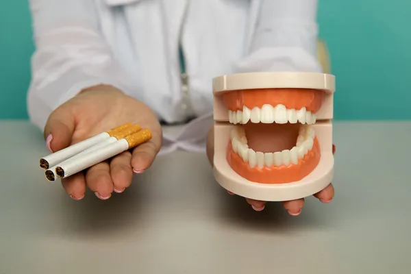Plastikowy model szczęki i papierosa w rękach dentysty. Uzależnienie od palenia — Zdjęcie stockowe