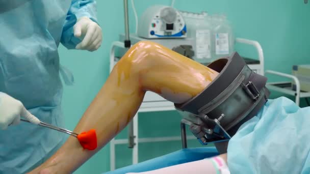 Chirurg leczy nogę pacjenta przed operacją — Wideo stockowe