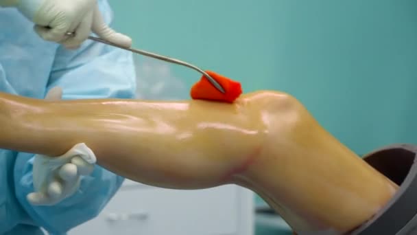 Il chirurgo cura la gamba dei pazienti prima dell'intervento — Video Stock