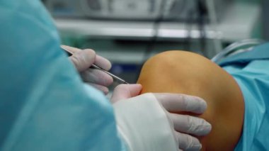 Cerrah, kamerayı yerleştirmek için diz eklemine bir kesik atar.