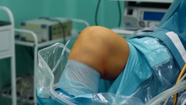 El cirujano está listo para iniciar la cirugía de rodilla — Vídeo de stock