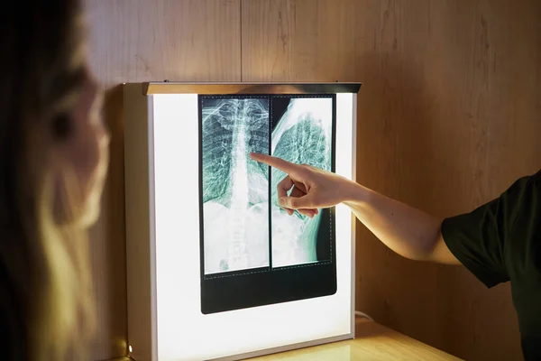 A doctor showing her patient the results of a spinal X-ray. Health concept. She indicates with her finger where the problem is.