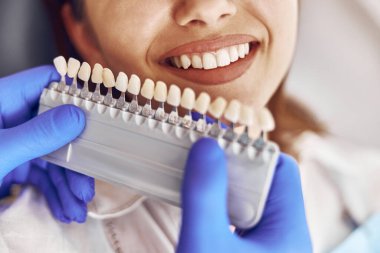 Profesyonel doktor modern diş kliniğinde diş rengini seçiyor.