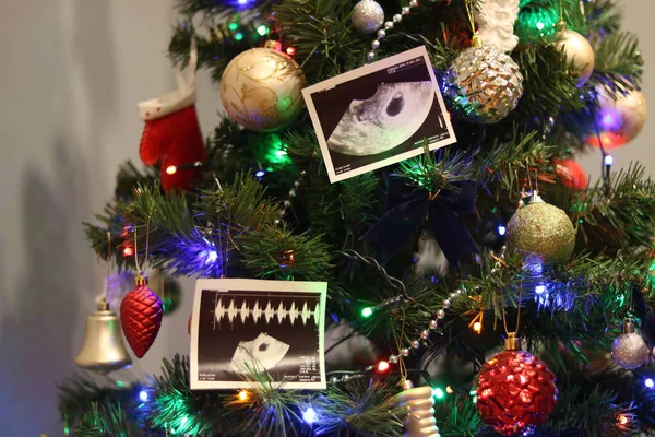 Pregnancy ultrasound pictures hanging on the Christmas tree. Christmas time.