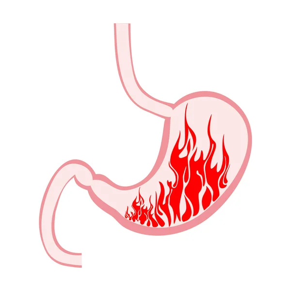 Stomach Fire Excessive Acidity Indigestion Stomach Disease Gastric Ulcer Severe — стоковый вектор