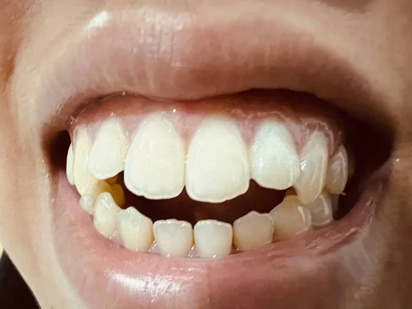 Закрыть Рот Зуб — стоковое фото