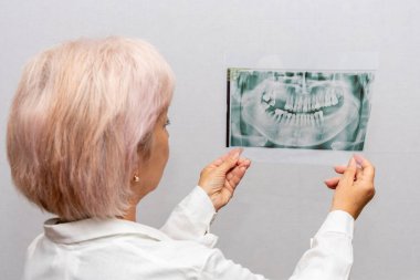 a dentist looks at an X-ray of teeth and jaw on a white background. Concept: treatment and prosthetics of the dental oral cavity.