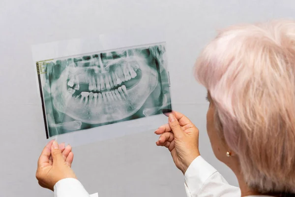 Dentist Looks Ray Teeth Jaw White Background Concept Treatment Prosthetics — Stock fotografie